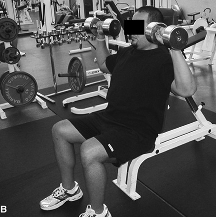 développé militaire blessure musculation